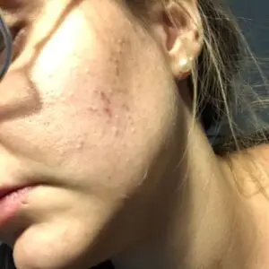 before hautpflegeroutine